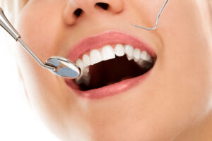 Cosmetic Dentistry