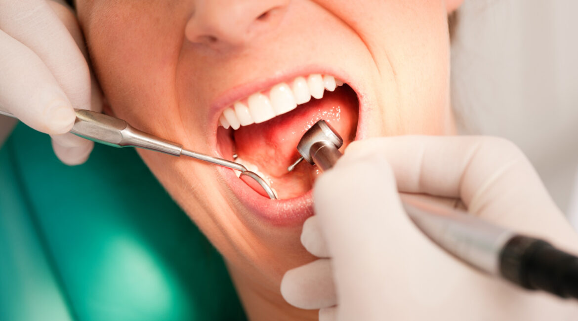 dental treatment
