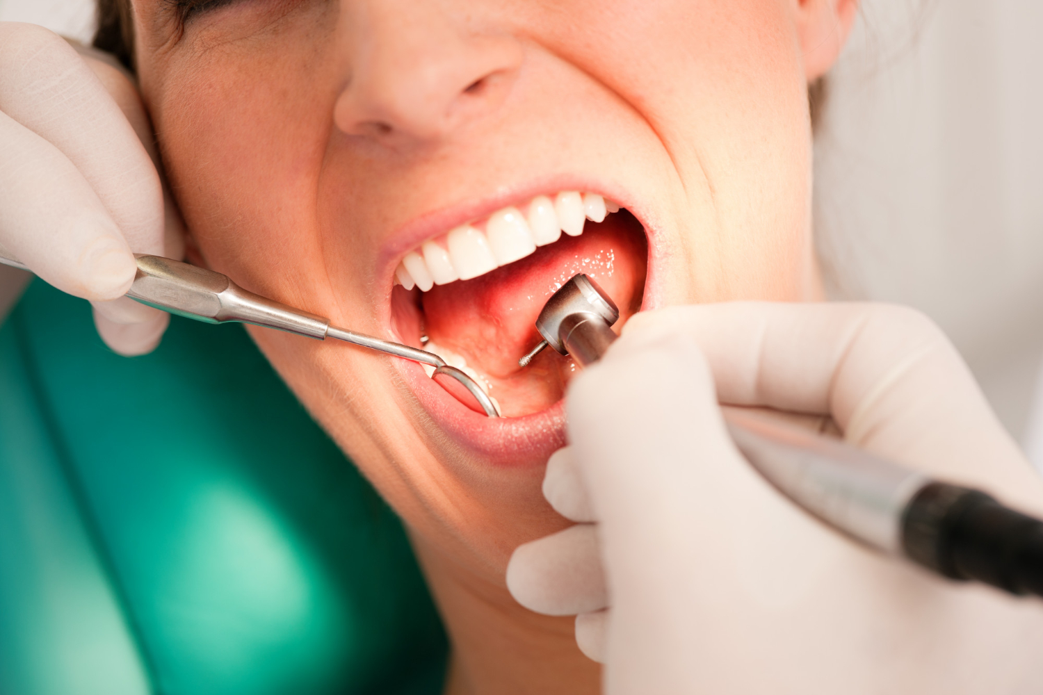 dental treatment